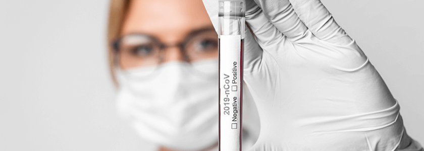 Nuevas medidas en Surveco contra el Coronavirus (23-03-2020) - Surveco Nuevas medidas en Surveco contra el Coronavirus (23-03-2020) - Surveco